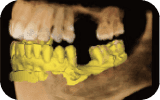 Three-dimensional jaw imaging example