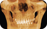 Three-dimensional dental imaging example