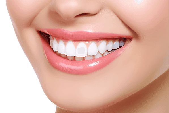 Una sonrisa radiante